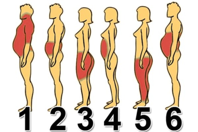 6 типов ожирения и подсказки, как справиться с каждым из них