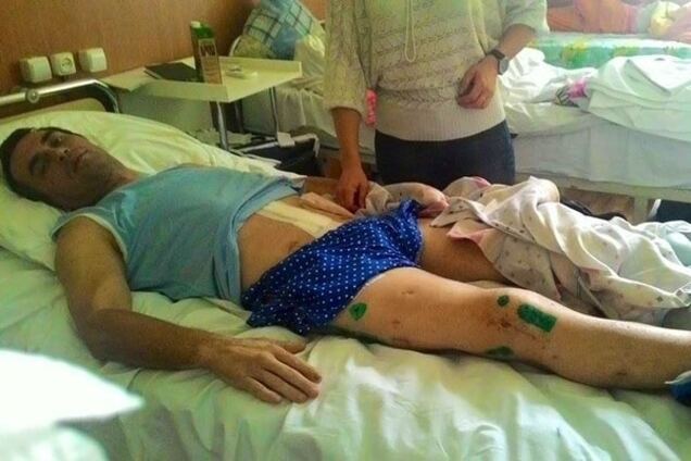 'На нем нет живого места': тяжело раненному бойцу АТО срочно нужна помощь
