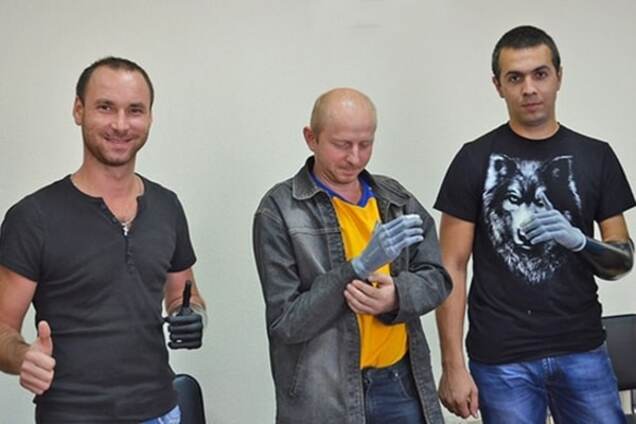 В Италии трем бойцам АТО сделали руки 'киборгов': фотофакт