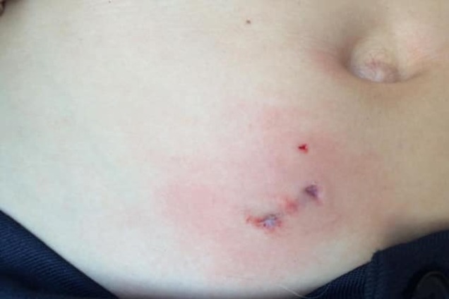 В Киеве бойцовая собака напала на школьника