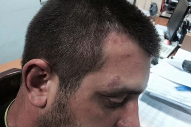 Задержанного за события под ВР 31 августа били палкой по голове – адвокат