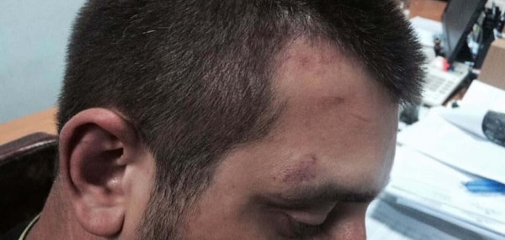 Затриманого за події під ВР 31 серпня били палицею по голові - адвокат