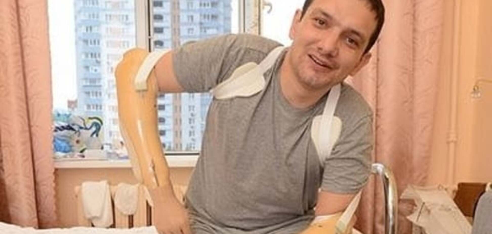 Санинструктор после Дебальцево остался без рук и ног: опубликованы фото