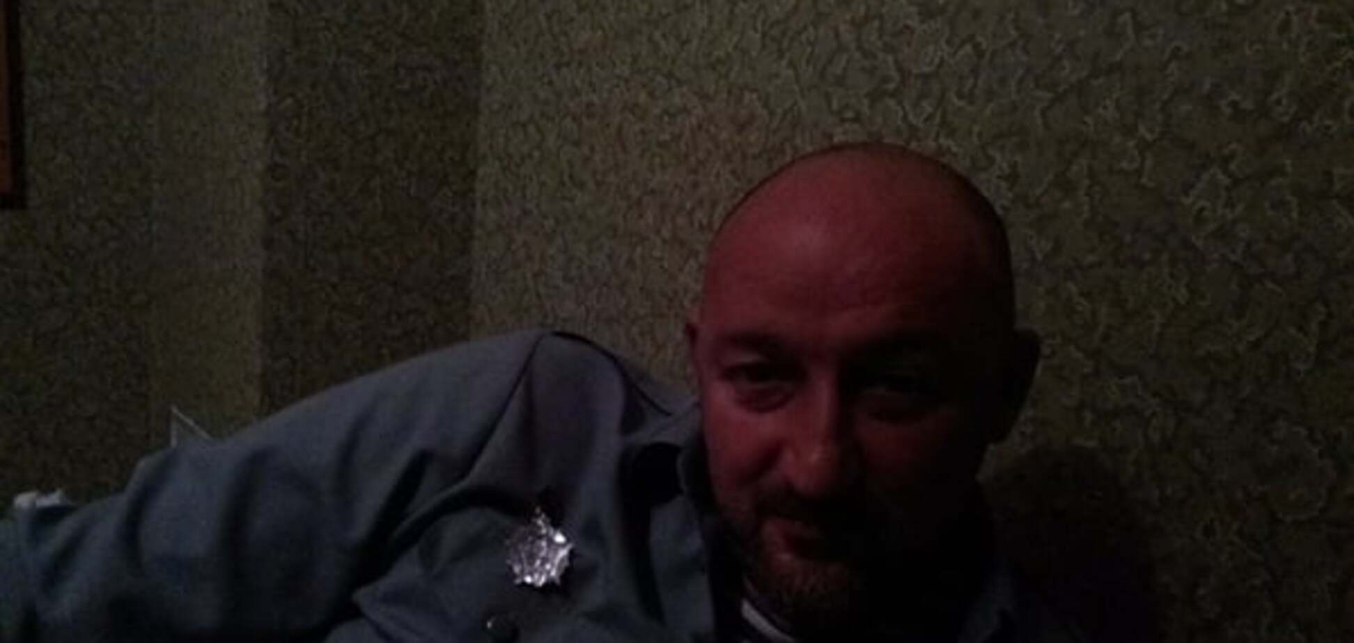 'Заживет как на овчарке': побитый Мочанов показал свое фото