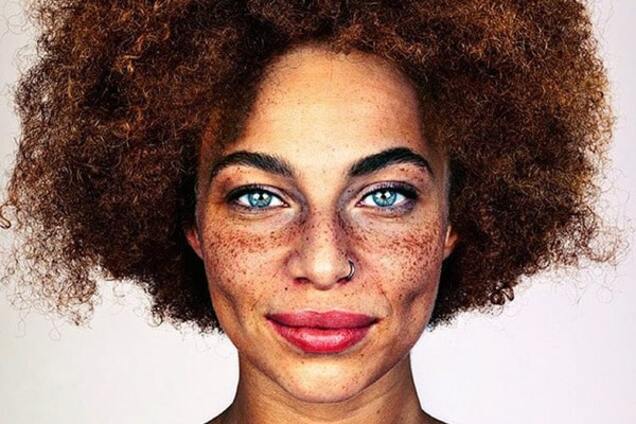 Поцелованные солнцем: уникальная красота людей с веснушками