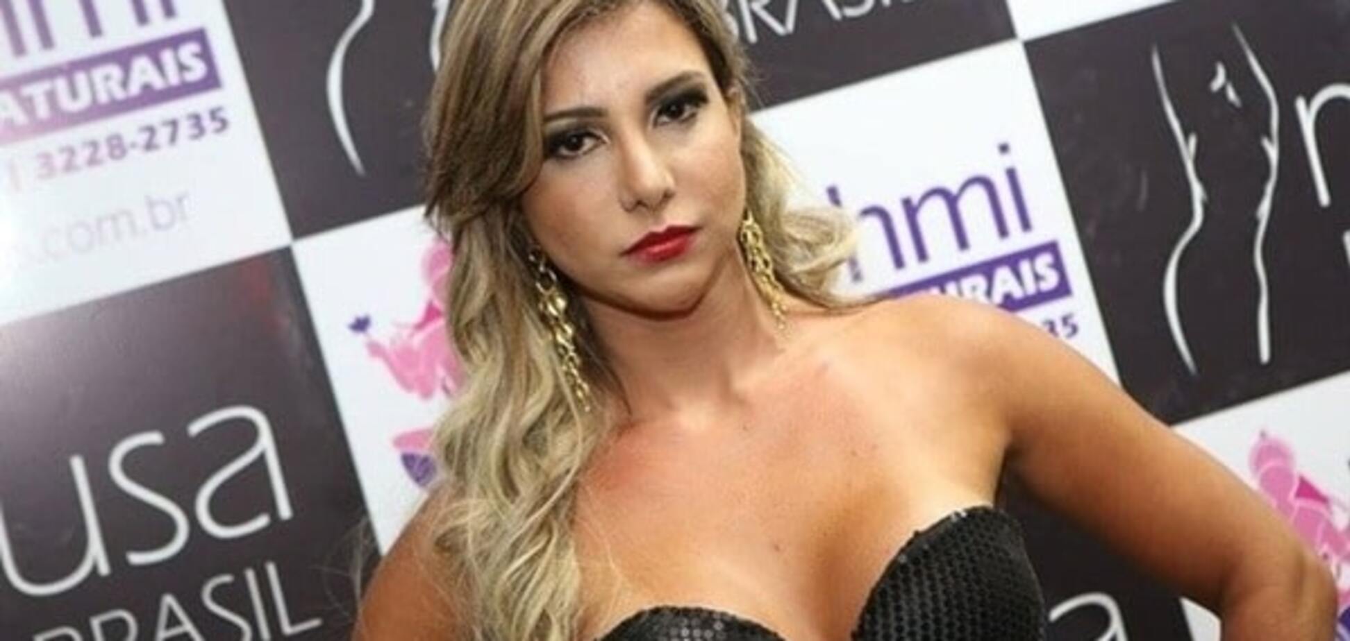 Жертва пластики: 28-летняя бразильская модель умерла после операции