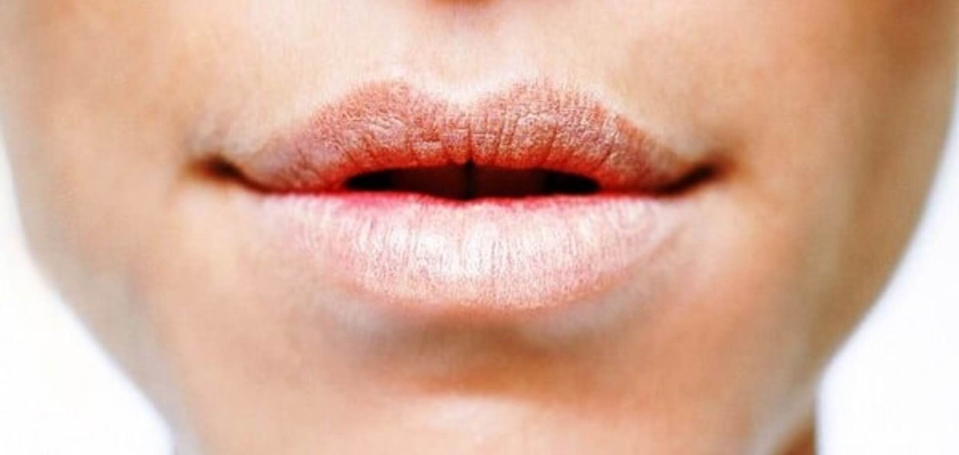 Как избавиться от трещин в уголках губ: лайфхаки от экспертов