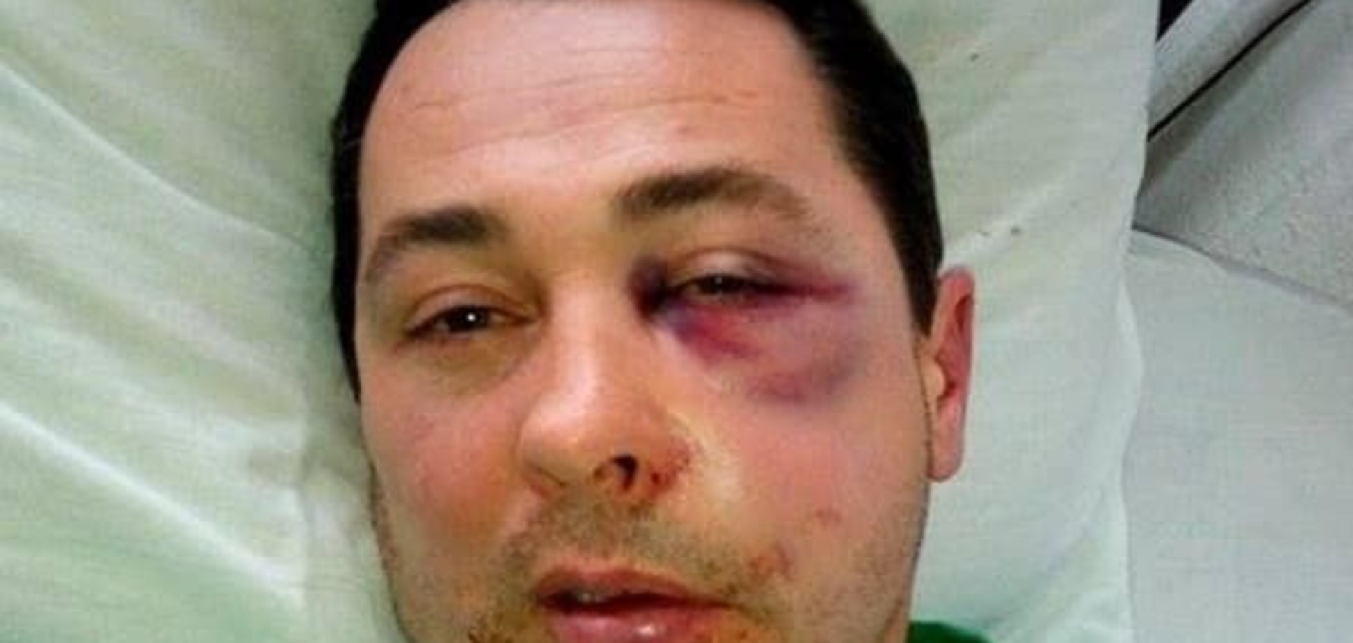 На Херсонщине избили депутата от БПП