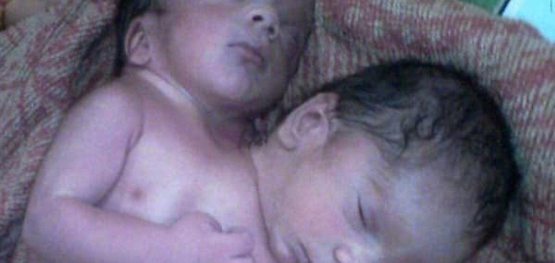 Чудо природы: в Индии родился двухголовый ребенок. Фотофакт