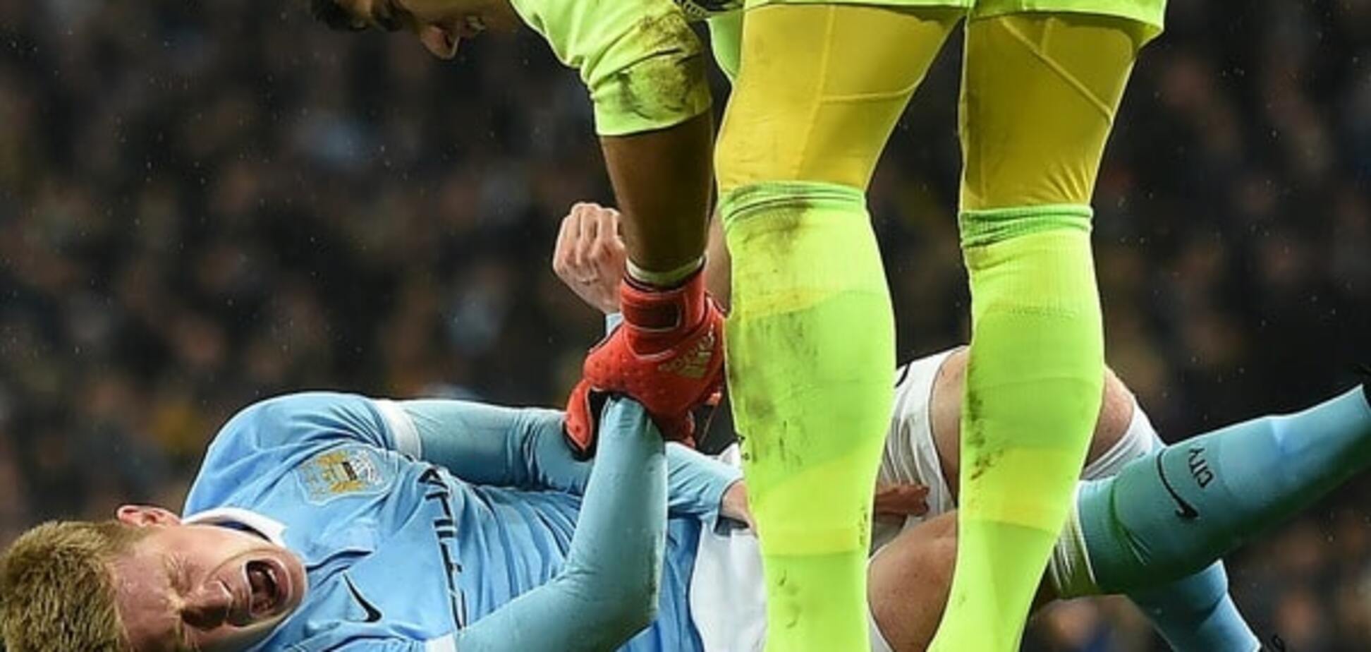 Карма настигла. Лидер 'Манчестер Сити', унизивший 'Динамо', получил серьезную травму: видео инцидента