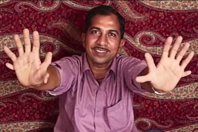 Чудеса природы: в Индии живет мужчина-рекордсмен с 28-мя пальцами