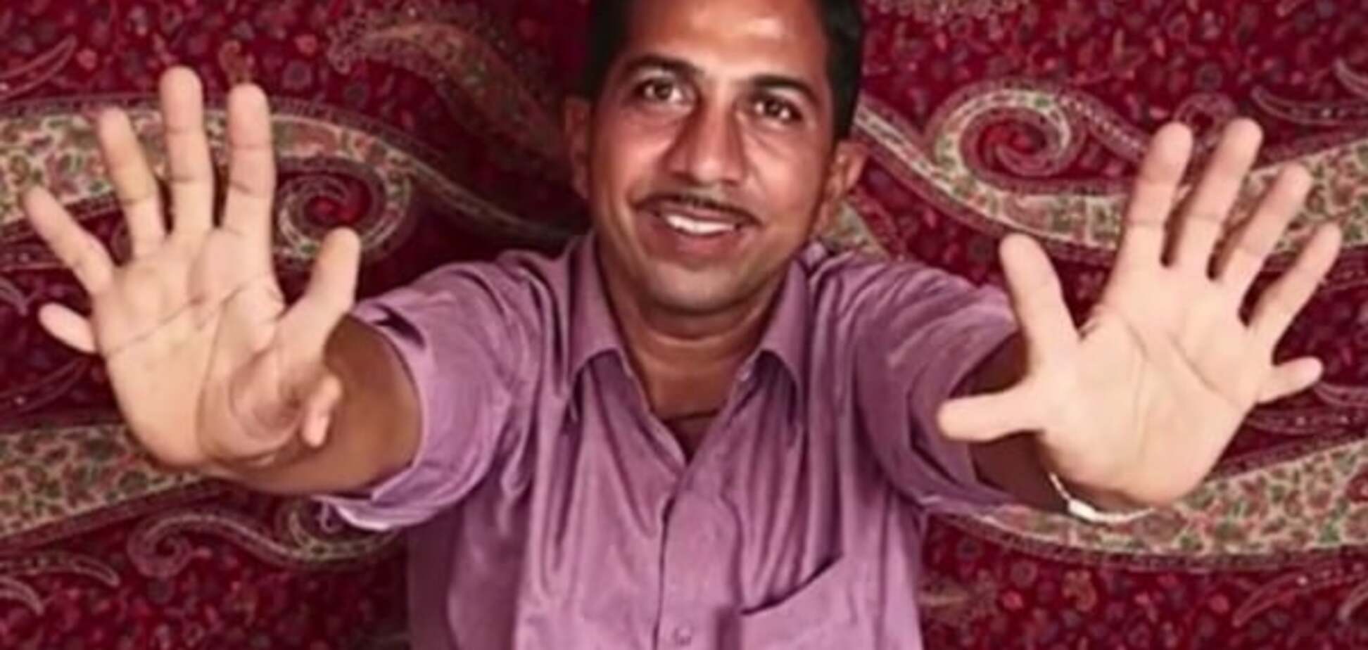 Чудеса природы: в Индии живет мужчина-рекордсмен с 28-мя пальцами