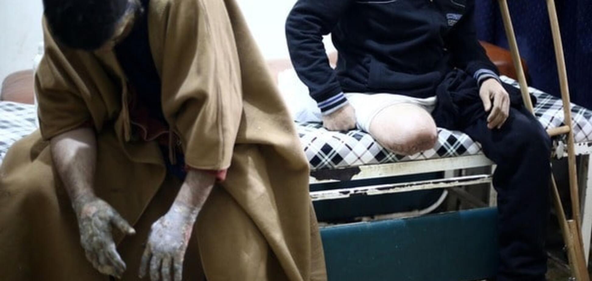 Сирійський конфлікт через Путіна стане ще більш запеклим - журналіст