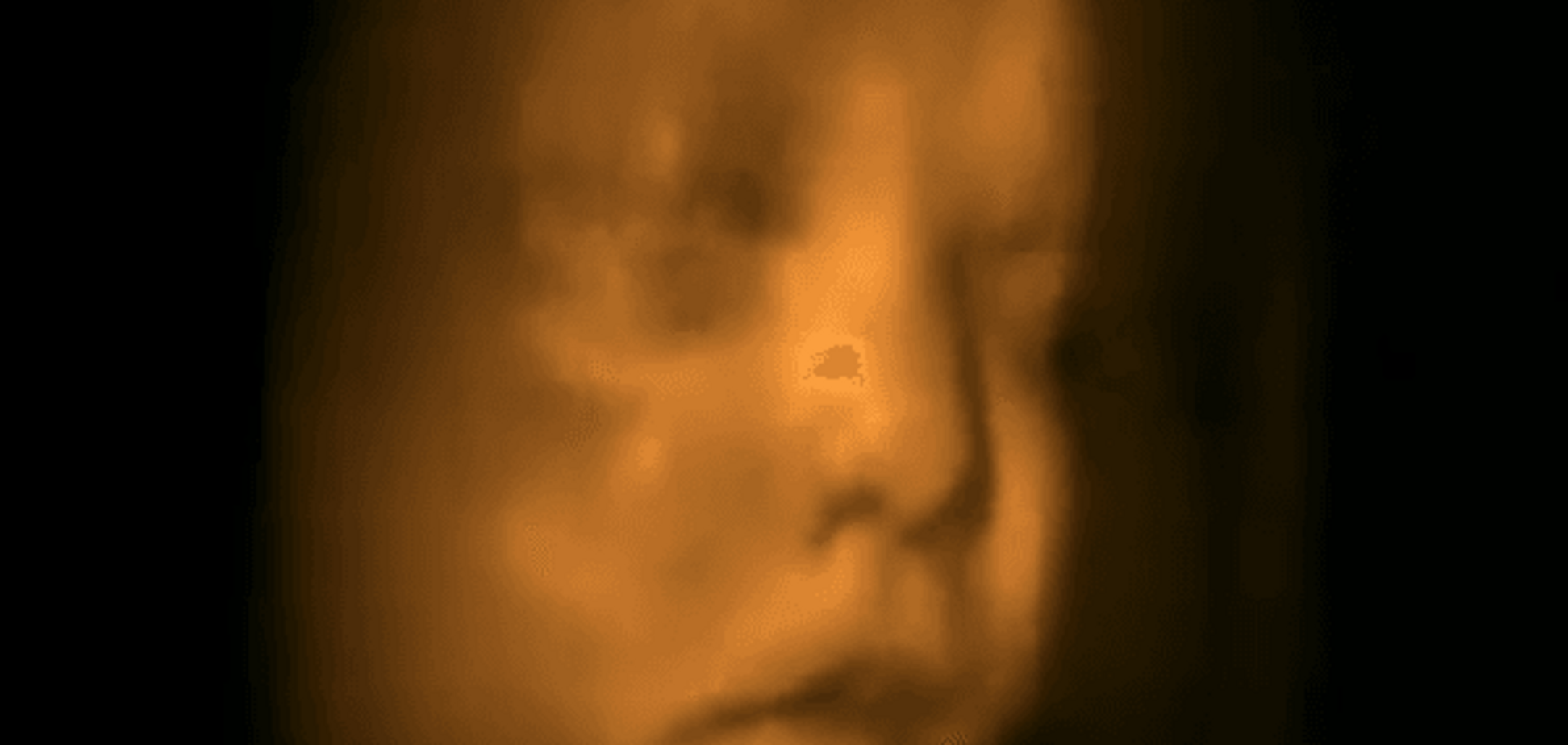 Вы будете в шоке: сеть взорвало видео танца ребенка в утробе матери