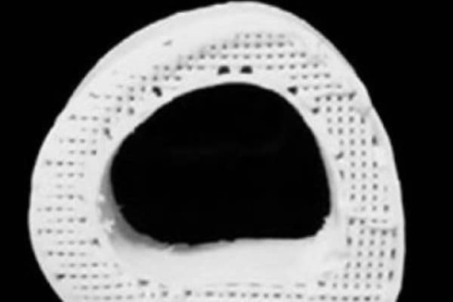 Искусственную костная ткань, напечатанная на 3D-принтере