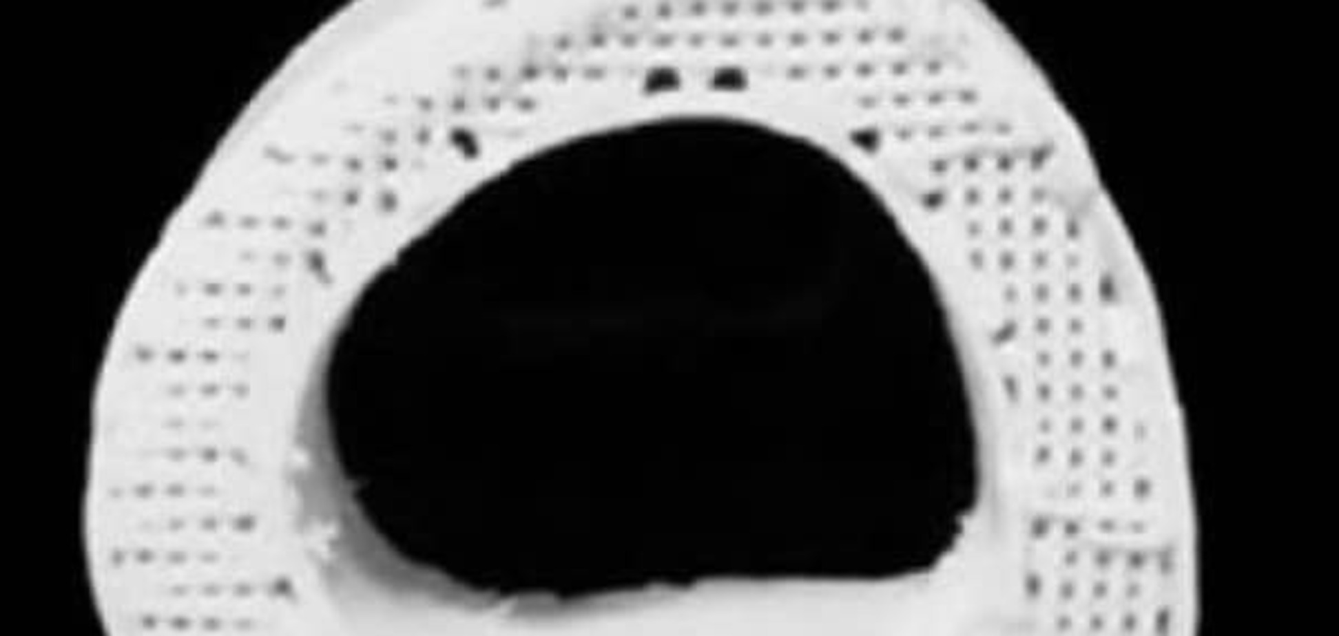 Искусственную костная ткань, напечатанная на 3D-принтере