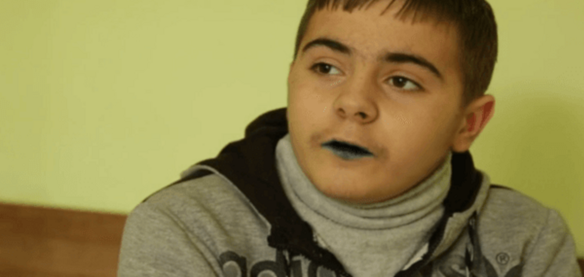 13-річний Андрій зі Львова