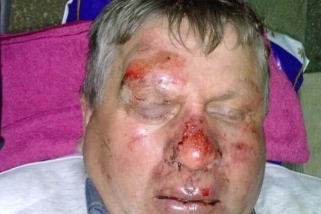 Побиття підприємця