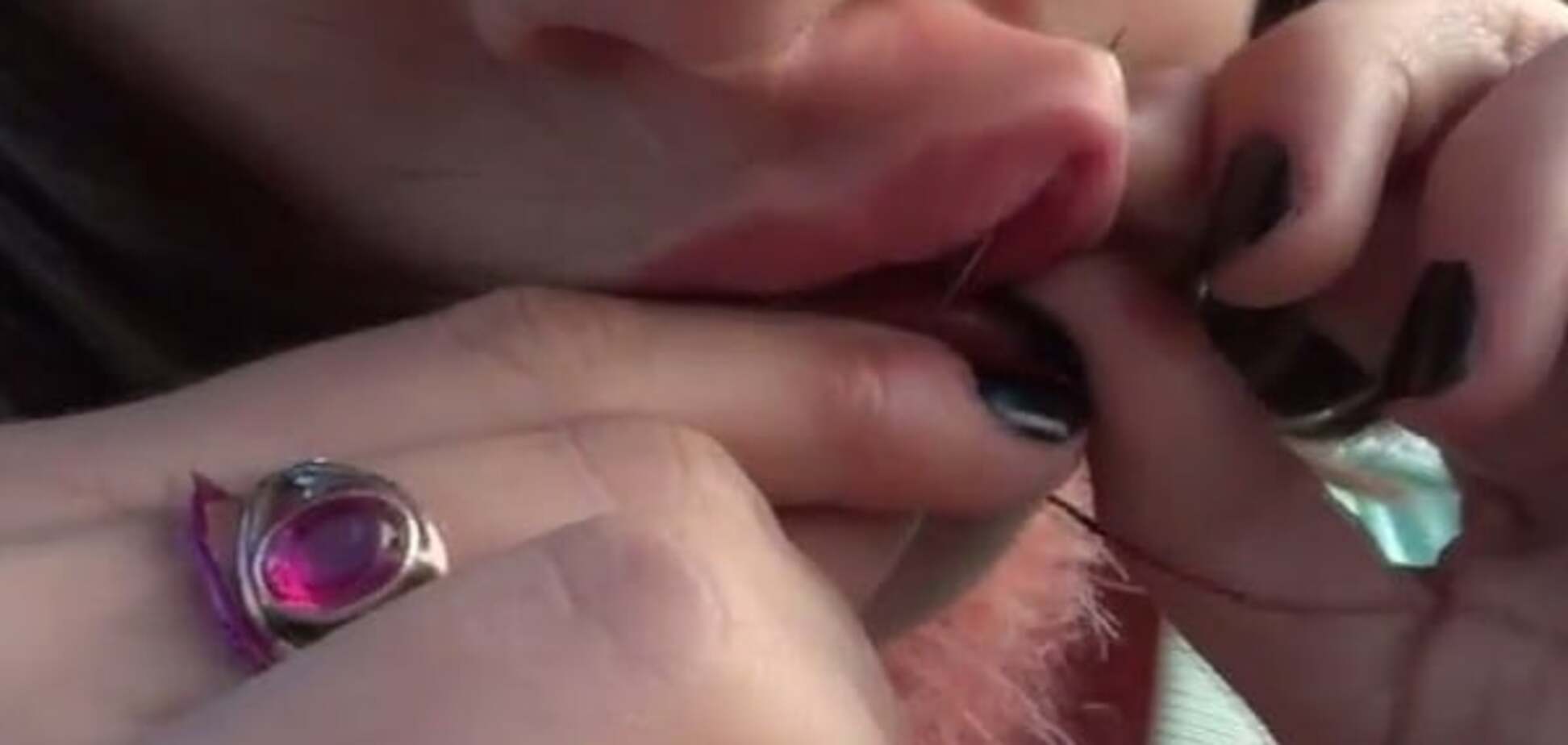 В Запорожье школьница изуродовала своё тело ради просмотров на YouTube