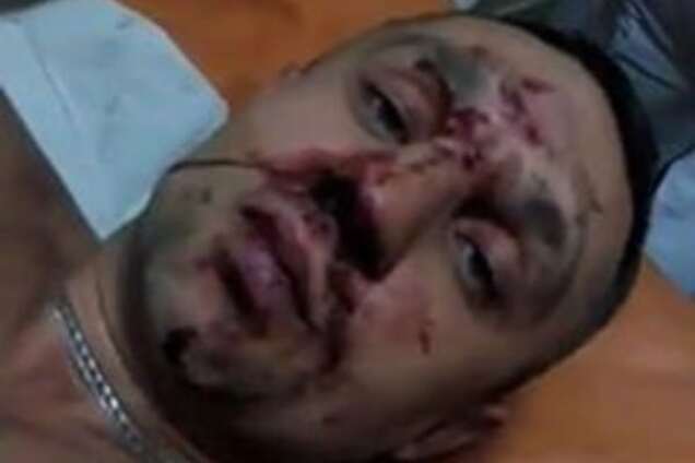 пострадавший