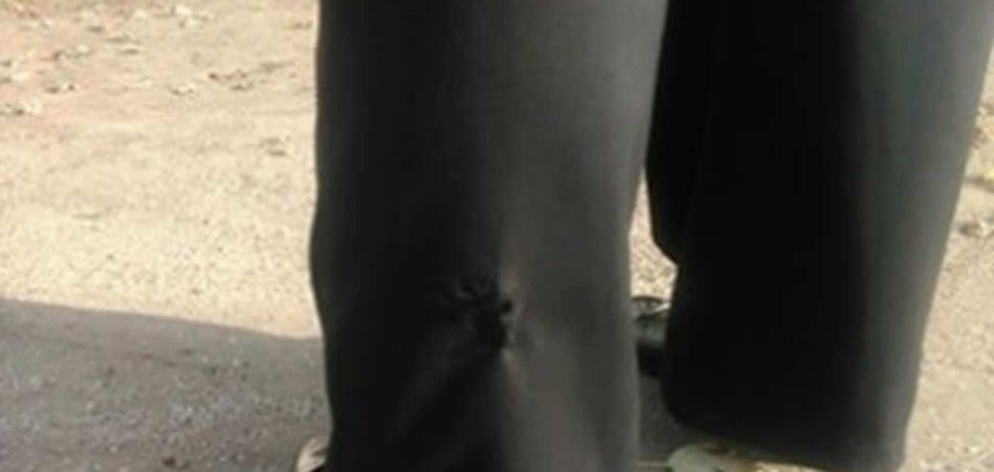 Жителей Запорожской области атакуют бездомные собаки