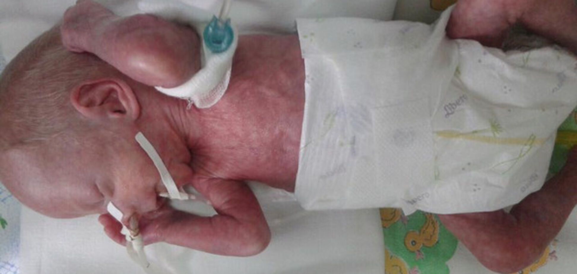 Пересада Артем