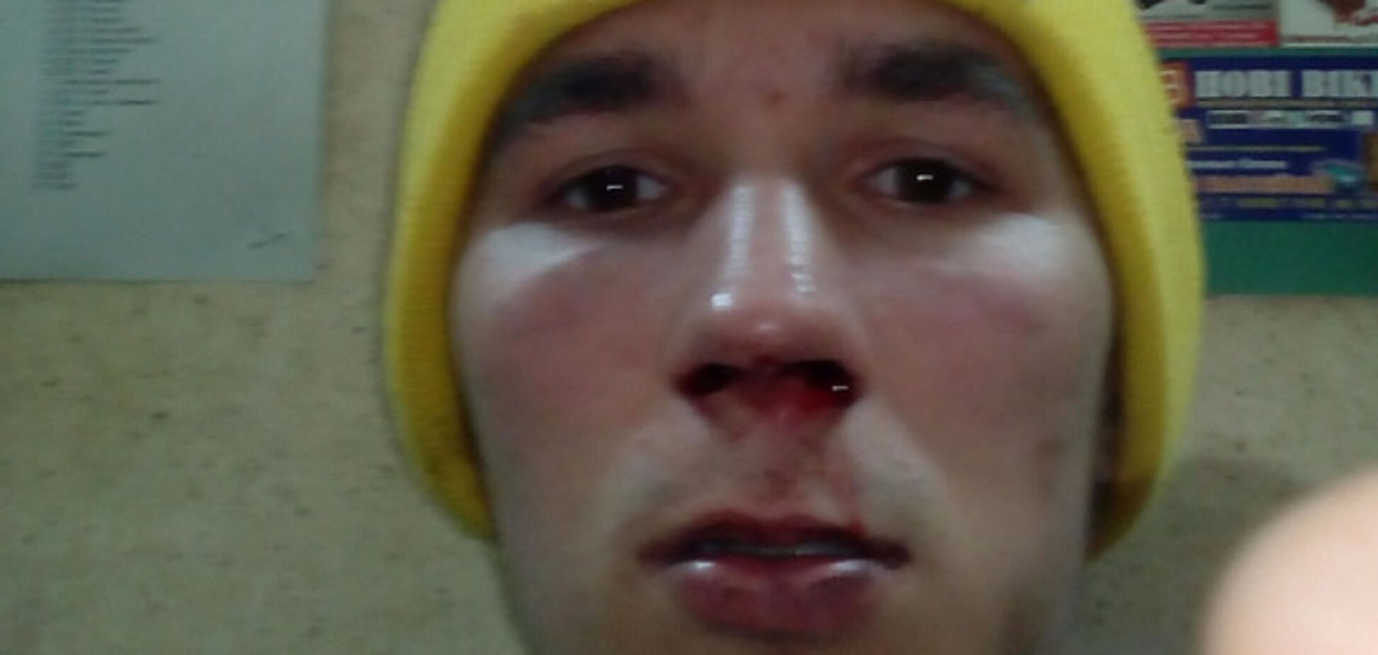 В Запорожской области парня избили за то, что он исполнял рэп