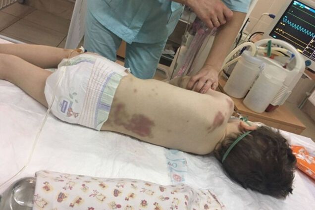 Ребенок находится в коме