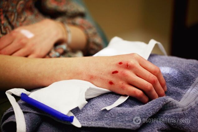 Пострадавшие