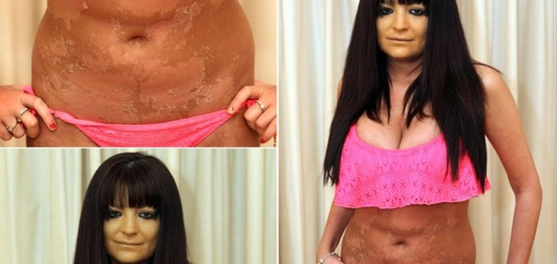 Порноактриса после солярия покрылась жуткими пятнами: опубликованы фото