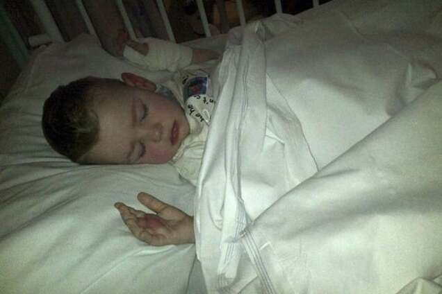 2-летнего ребенка парализовало после укуса паука, прятавшегося в бананах