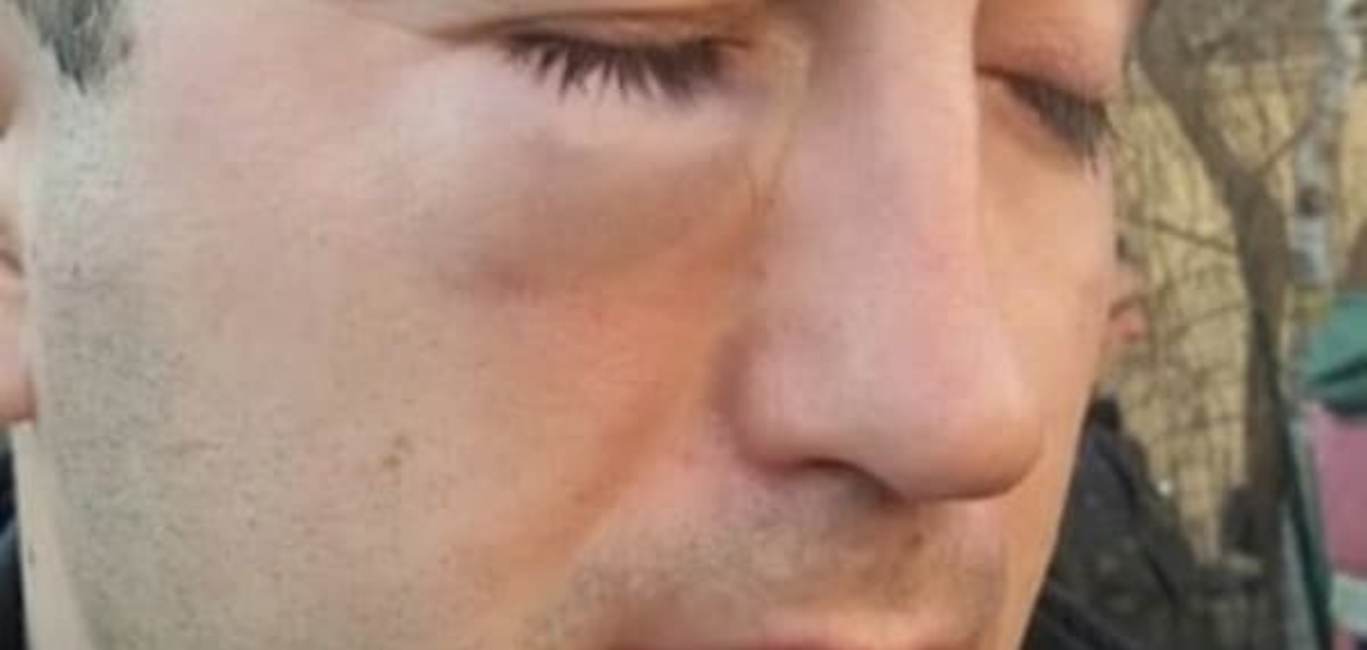 Драка чиновника РГА с экс-бойцом АТО: в полиции Киева сообщили подробности