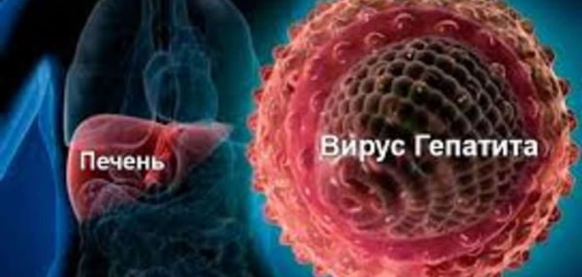 У київському вузі виявили спалах гепатиту А