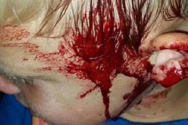 Страшний випадок в Австралії: гігантський пітон ледь не з'їв дитину