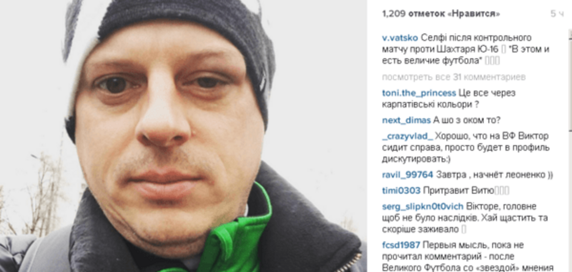 Футболисты 'Шахтера' подбили глаз знаменитому украинскому комментатору: фотофакт