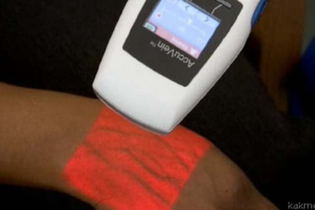 Инновация в медицине: появился прибор для подсветки вен