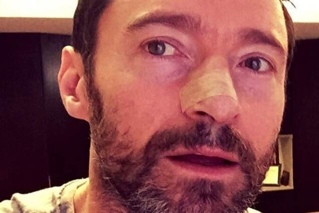 У Хью Джекмана рецидив: актер снова борется с раком