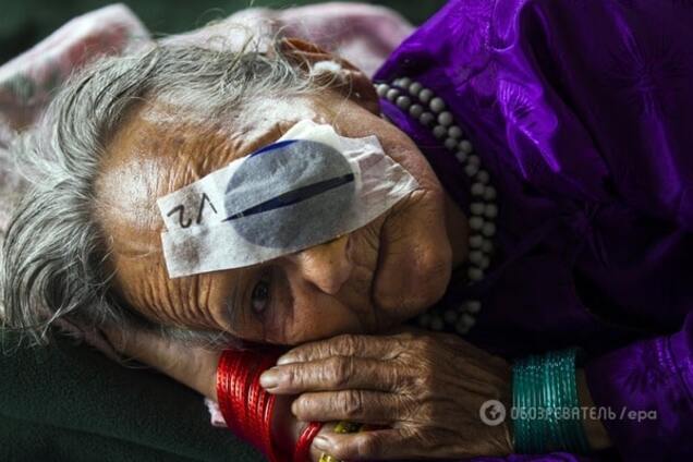 Катаракта, прочь: в Японии ученые почти вырастили глаза