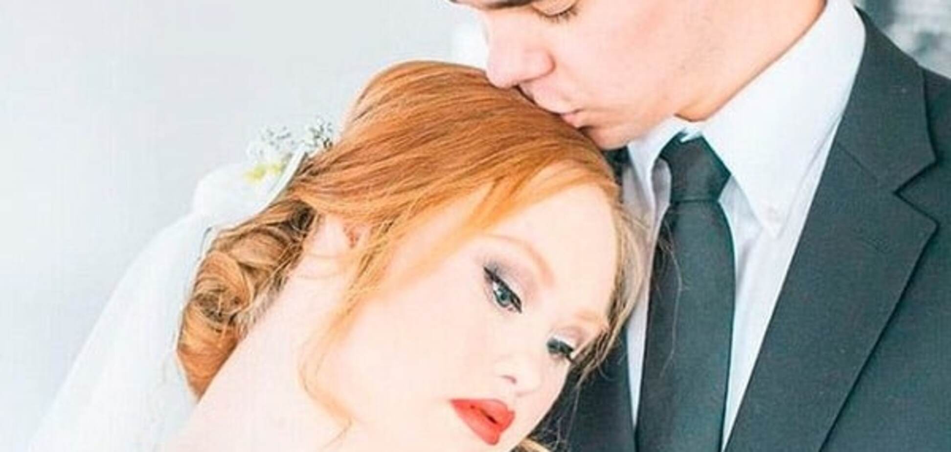 Модель с синдромом Дауна поразила свадебными фото