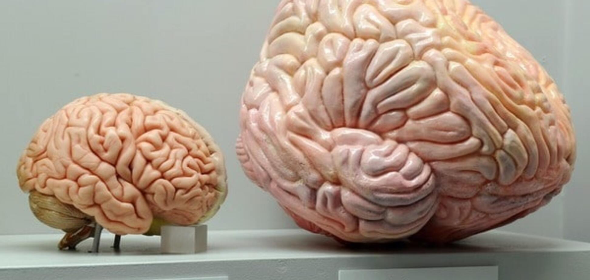 Ученые выяснили, как эффективно увеличить размер мозга