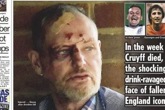 Легендарный футболист сборной Англии найден пьяным с разбитой головой: жуткие фото