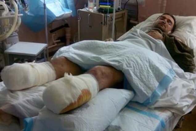 Потерявший в АТО ноги боец нуждается в помощи