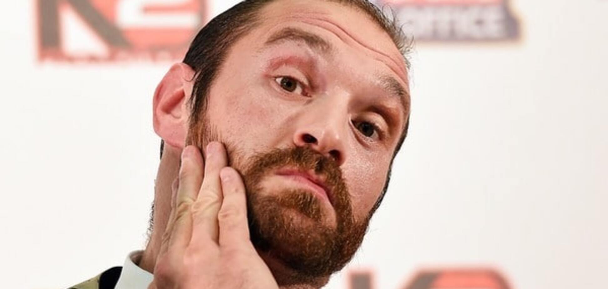 Тайсон Фьюри