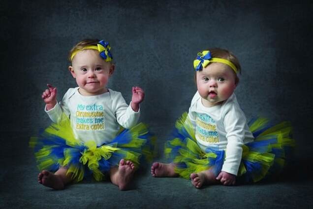 Малышки с синдромо Дауна