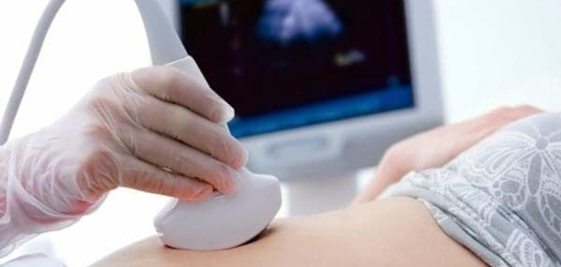 Женское бесплодие победят напечатанные на 3D-принтере яичники