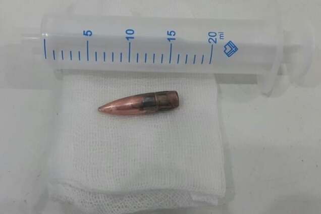 Бойца АТО ранили на Донбассе