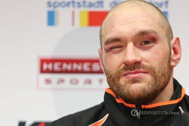 Тайсон Фьюри