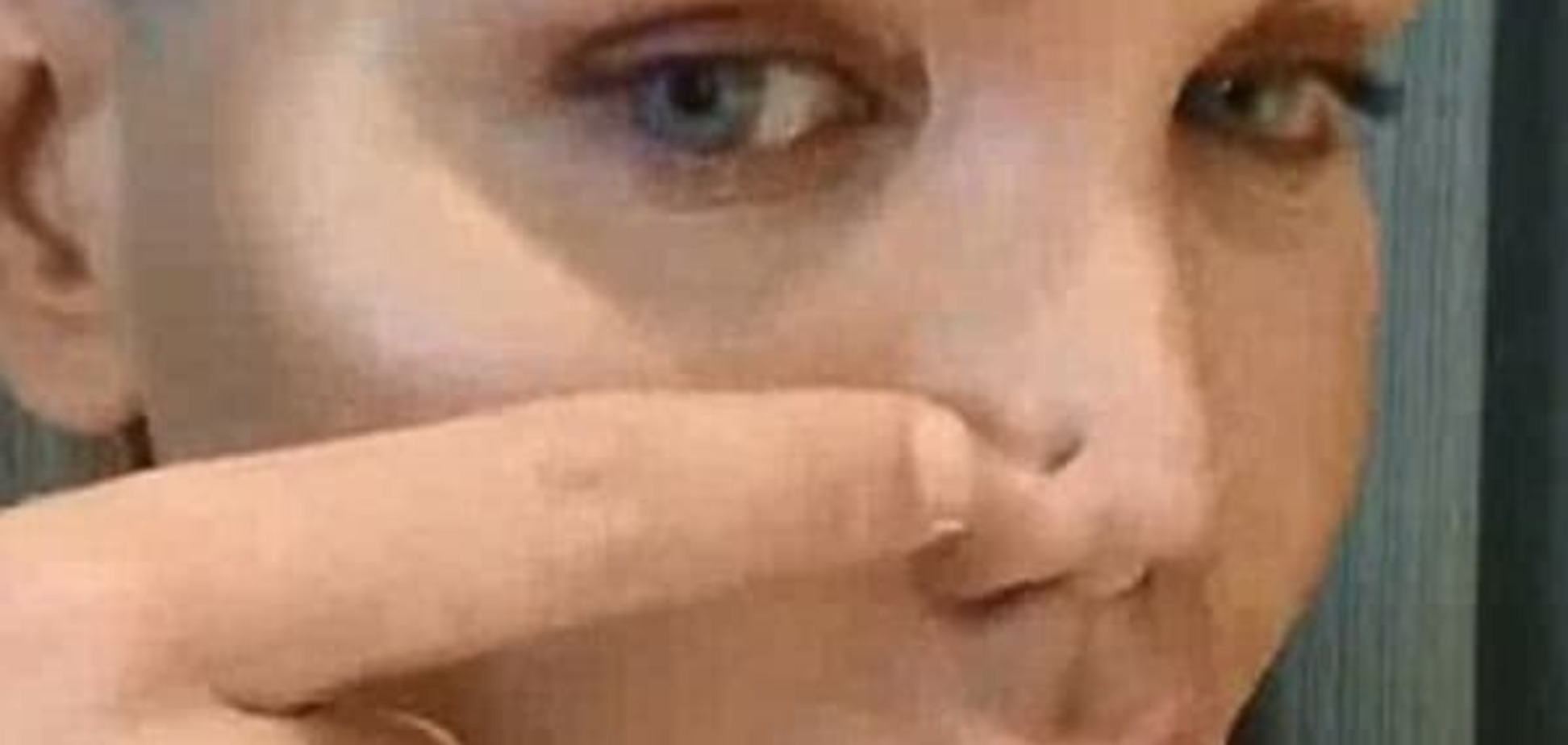 неудачная пластика