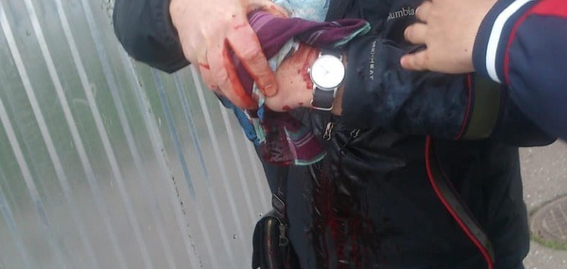 На Куликовому полі в Одесі прогримів вибух: є постраждалий