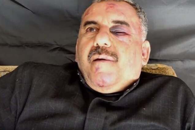 'Я не знаю, что меня ждет': в сеть выложили видео допроса сирийского пилота